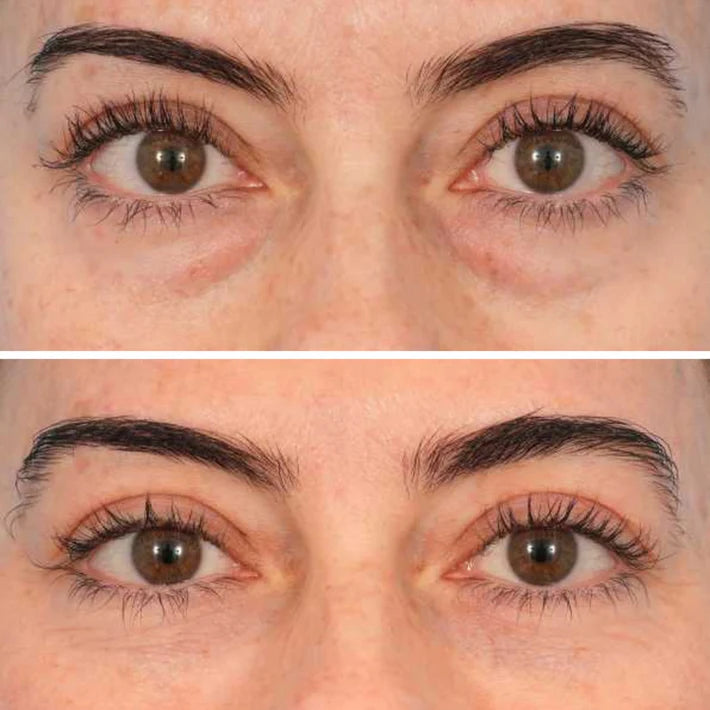Deep Peptide Collagen Eye Mask
