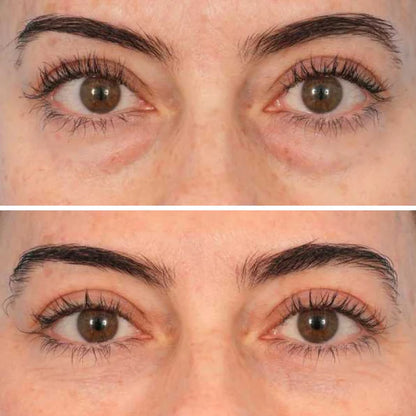 Deep Peptide Collagen Eye Mask