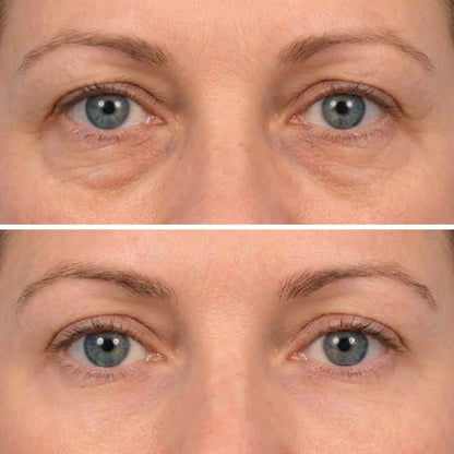 Deep Peptide Collagen Eye Mask