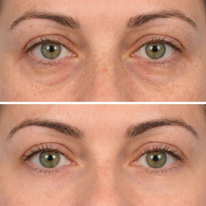 Deep Peptide Collagen Eye Mask