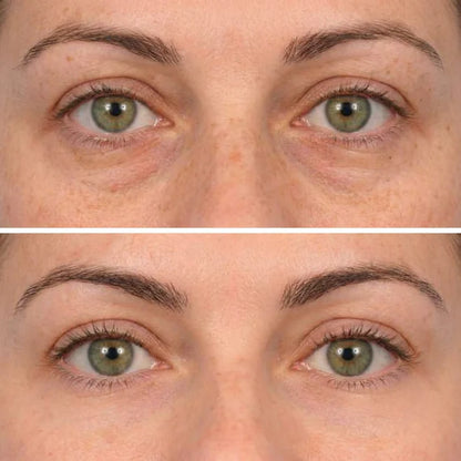 Deep Peptide Collagen Eye Mask