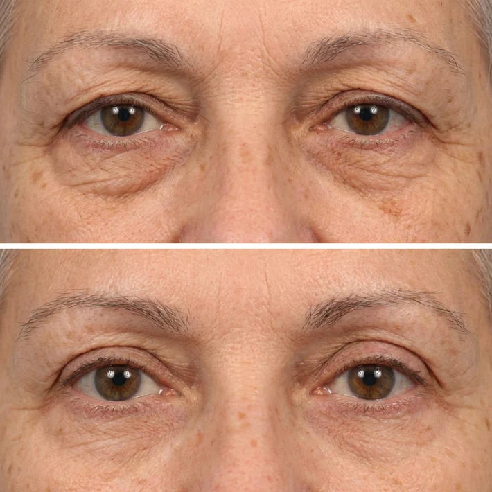 Deep Peptide Collagen Eye Mask