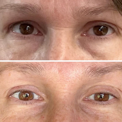 Deep Peptide Collagen Eye Mask